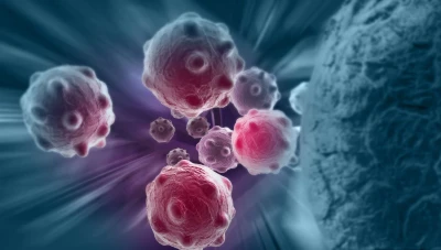 اكتشاف هـام يمكن أن ينقذ مرضى السـرطان في مراحل متأخرة من تطور الاورام
