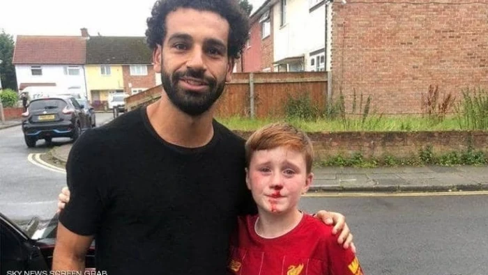 محمد صلاح ينقذ &#34;الطفل النازف&#34;